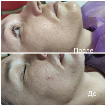 Елена Меркотан, Херсон Фото - 2