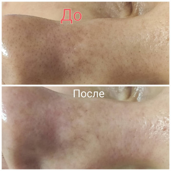 Елена Меркотан, Херсон Фото - 4