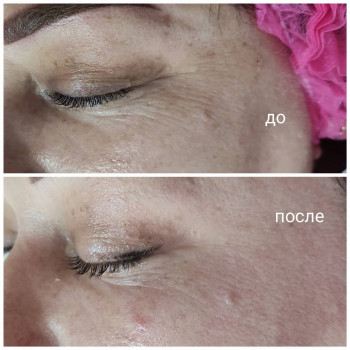 Елена Меркотан, Херсон Фото - 8