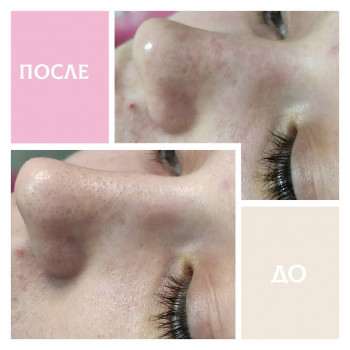 Елена Меркотан, Херсон Фото - 9