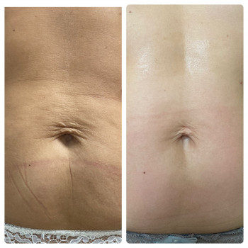 Kvitka Lotosa, Ирпень Фото - 18