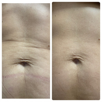 Kvitka Lotosa, Ирпень Фото - 19