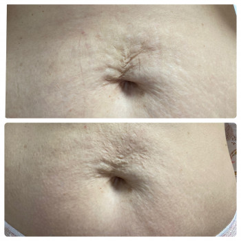 Kvitka Lotosa, Ирпень Фото - 20