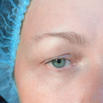 До процедуры