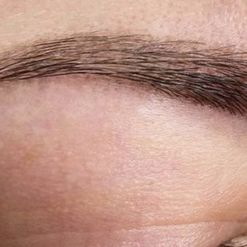 Зажившая бровь