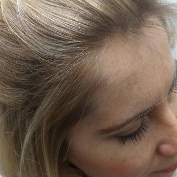 АирТач/мягкий переход в корень
Чек3000
Время 3,5 часа