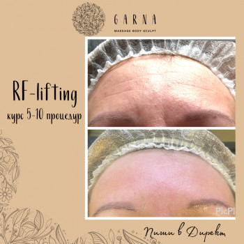 GARNA, Мариуполь Фото - 5