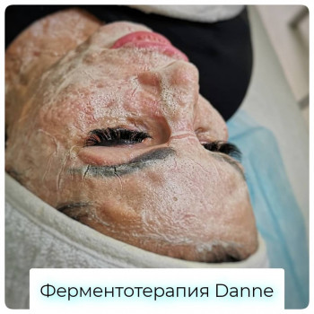 GENETIX, Одесса Фото - 26