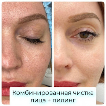 GENETIX, Одесса Фото - 28