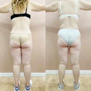 Фото з портфоліо майстра Анастасія Макарова (масажист, Львів)