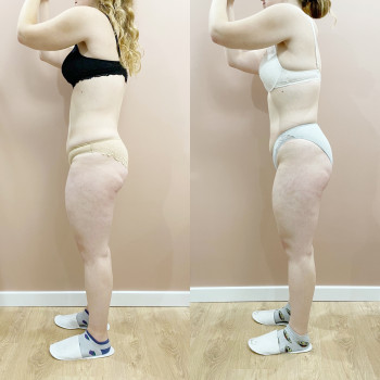 Фото з портфоліо майстра Анастасія Макарова (масажист, Львів)