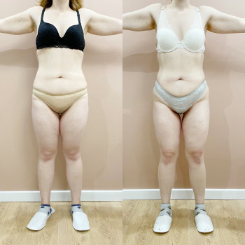 Фото з портфоліо майстра Анастасія Макарова (масажист, Львів)