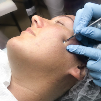 Комбинированная чистка