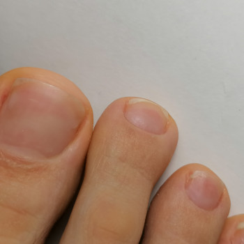 Педикюр
                    Майстер манікюру Оксана Київ