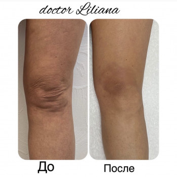 Доктор Лилиана, Одесса Фото - 83