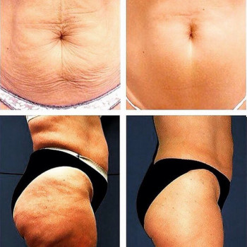 корекція фігури, обгортання тіла, масаж тіла, косметологія тіла