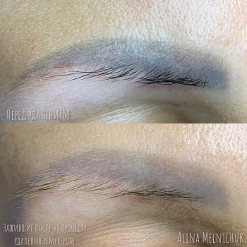 Алина Мельничук, Киев Фото - 21