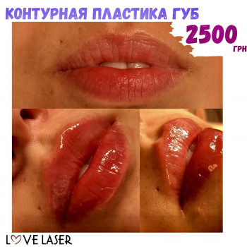 LoveLaser, Чернигов Фото - 24