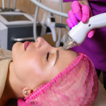 LoveLaser, Чернигов Фото - 29