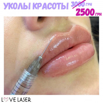 LoveLaser, Чернигов Фото - 31