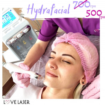 LoveLaser, Чернигов Фото - 34