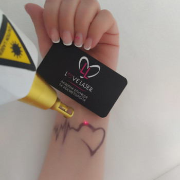 LoveLaser, Чернигов Фото - 37