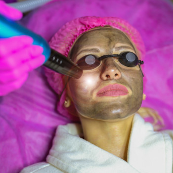 LoveLaser, Чернигов Фото - 40