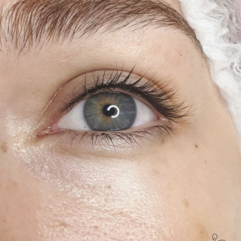 Межресничка