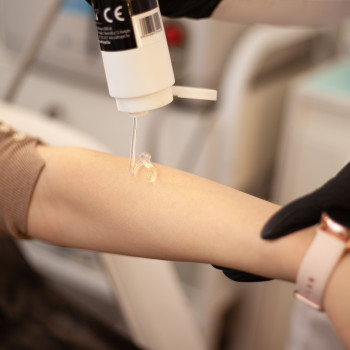 Лазерная эпиляция
                    Мастер перманентного макияжа Наталія Киев