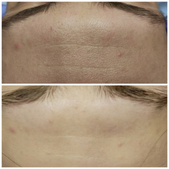 Татьяна Лукашенко, Бровары Фото - 3