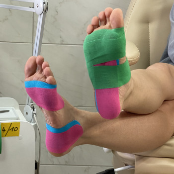 Кінезіотейпінг в кабінеті подолога
                    Подолог Лілія Черкаси