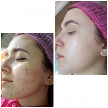 Тетяна Цюпенко, Хмільник Фото - 5