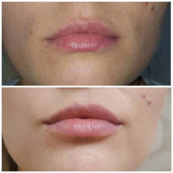 Тетяна Цюпенко, Хмільник Фото - 8