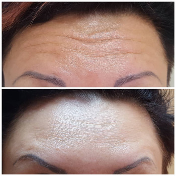 Тетяна Цюпенко, Хмільник Фото - 9