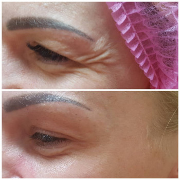 Тетяна Цюпенко, Хмільник Фото - 10