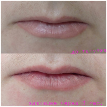 Заживший татуаж губ, перед коррекцией