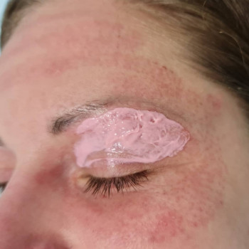 Плазма пен
                    Косметолог Мария Київ