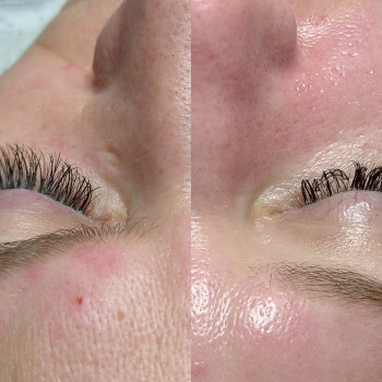 Чистка лица+пилинг