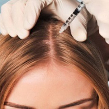 Мезотерапия лицо/декольте/руки/волосы
                    Салон красоты GOODLASHES Киев