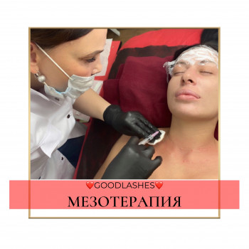 Мезотерапия лицо/декольте/руки/волосы
                    Салон красоты GOODLASHES Киев