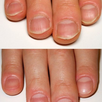 Рената , Львів Фото - 23