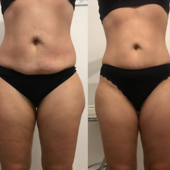 Інна Пугачова, Одеса Фото - 5