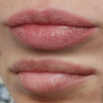 Заживший перманентный макияж губ