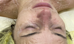 Ферментотерапія DMK Лікар-косметолог Дана Луцьк