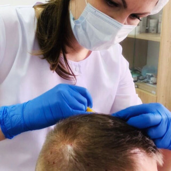 Мезотерапия волосистой части головы
                    Дерматолог косметолог Алёна Миколаїв