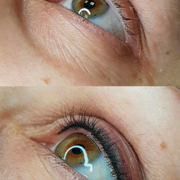 межресничка