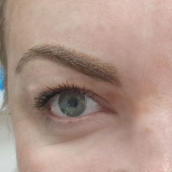 удаление татуажа