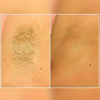 Валентина Кустовська, Біла Церква Фото - 4