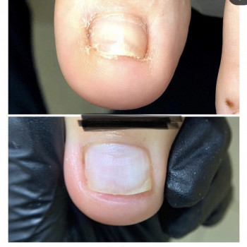 Маникюр
                    Майстер манікюру Дарья Київ