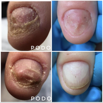 Маникюр
                    Майстер манікюру Дарья Київ
